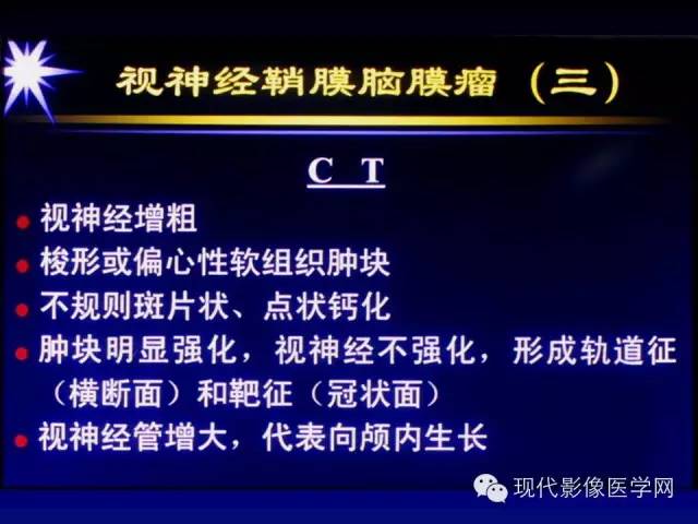 【PPT】眼眶肿瘤的CT MRI诊断