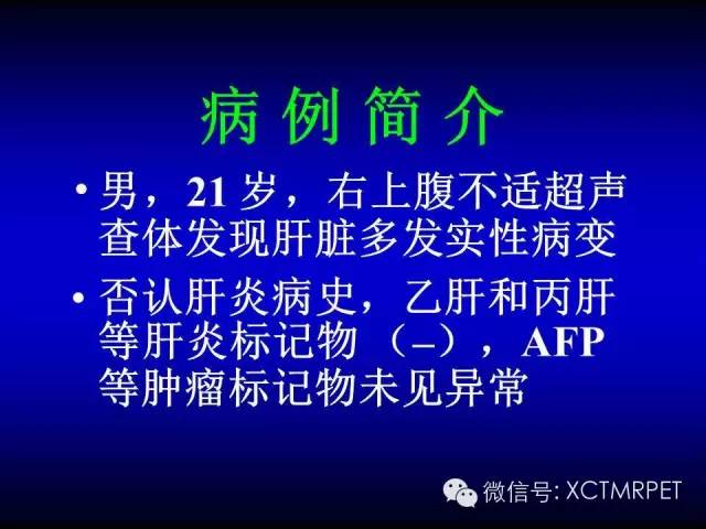 【PPT】肝脏FNH少见MRI表现与诊断