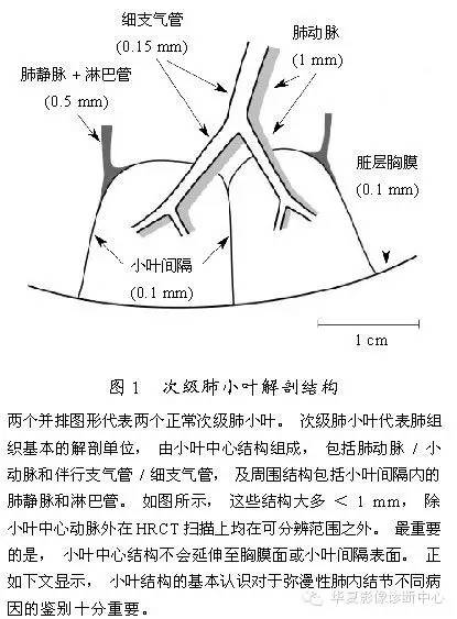 肺内多发结节的高分辨率CT鉴别诊断流程 肺内多发结节的高分辨率CT鉴别诊断流程