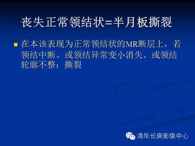 半月板的MR评价 半月板的MR评价
