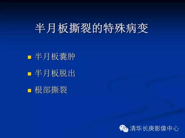 半月板的MR评价 半月板的MR评价