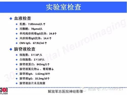 【病例】线粒体脑肌病1例MR影像诊断与思路分析