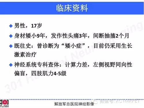 【病例】线粒体脑肌病1例MR影像诊断与思路分析