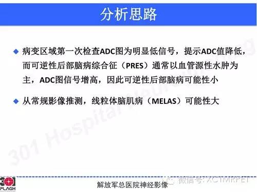 【病例】线粒体脑肌病1例MR影像诊断与思路分析