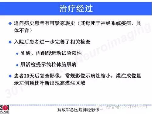 【病例】线粒体脑肌病1例MR影像诊断与思路分析