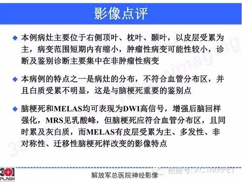 【病例】线粒体脑肌病1例MR影像诊断与思路分析