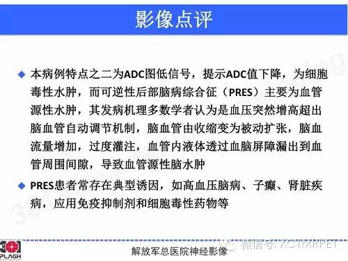 【病例】线粒体脑肌病1例MR影像诊断与思路分析