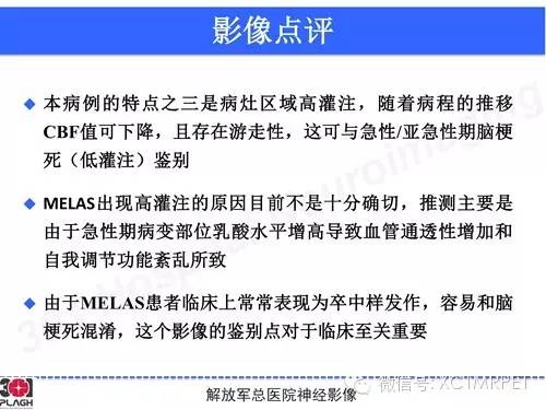 【病例】线粒体脑肌病1例MR影像诊断与思路分析