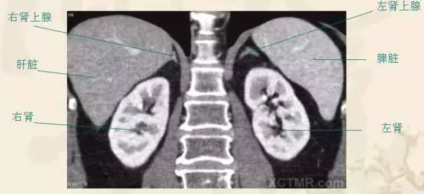 胸、腹、盆腔 CT解剖详解 胸、腹、盆腔 CT解剖详解