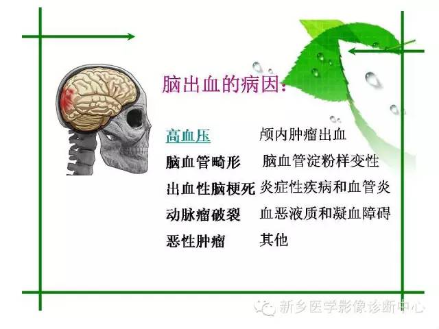 【PPT】颅内出血的MR诊断