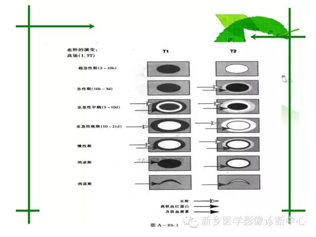 【PPT】颅内出血的MR诊断