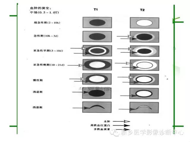 【PPT】颅内出血的MR诊断