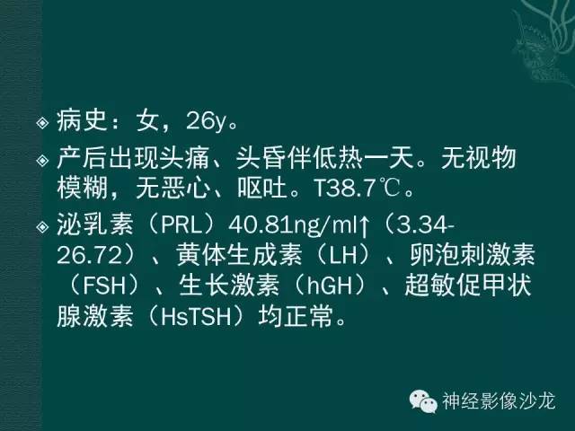 【病例】淋巴细胞性垂体炎1例MR影像表现