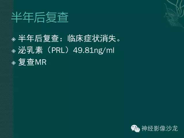 【病例】淋巴细胞性垂体炎1例MR影像表现
