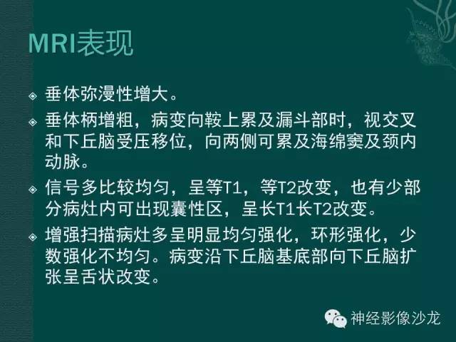 【病例】淋巴细胞性垂体炎1例MR影像表现