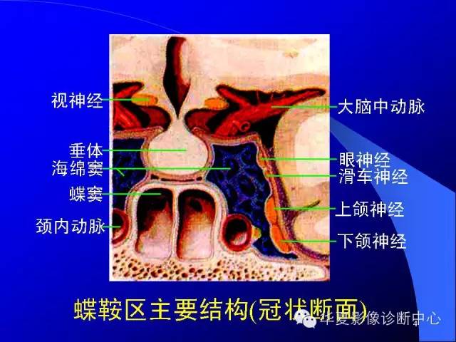 蝶鞍-脑室-脑池（高清+详细标注）