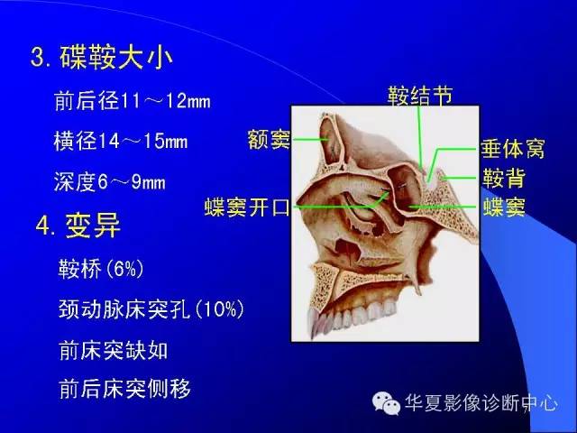 蝶鞍-脑室-脑池（高清+详细标注）