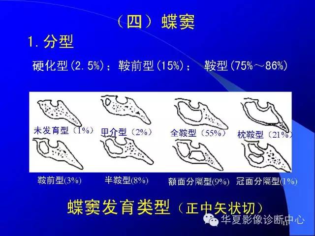 蝶鞍-脑室-脑池（高清+详细标注）