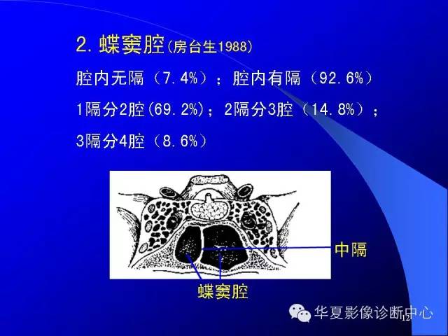 蝶鞍-脑室-脑池（高清+详细标注）