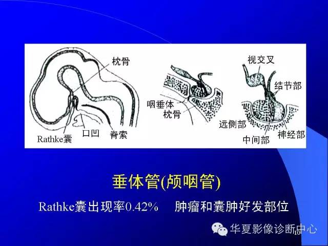 蝶鞍-脑室-脑池（高清+详细标注）