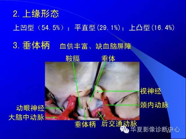 蝶鞍-脑室-脑池（高清+详细标注）