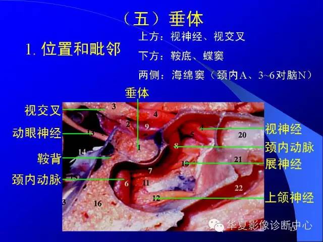 蝶鞍-脑室-脑池（高清+详细标注）