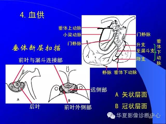 蝶鞍-脑室-脑池（高清+详细标注）