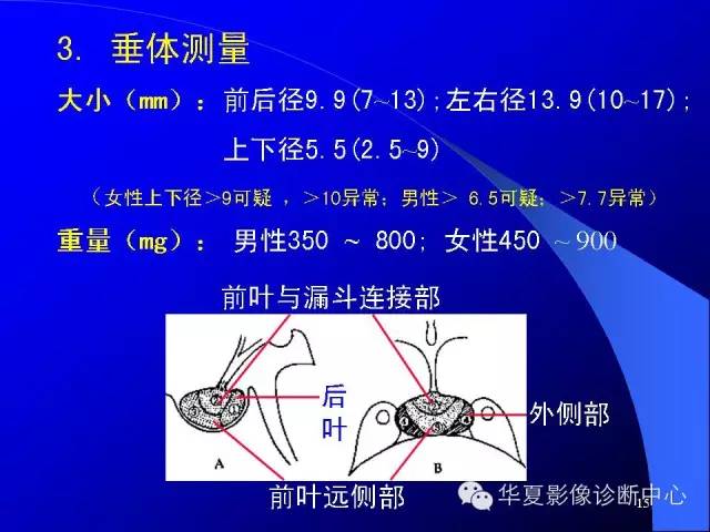 蝶鞍-脑室-脑池（高清+详细标注）