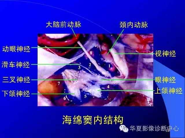 蝶鞍-脑室-脑池（高清+详细标注）