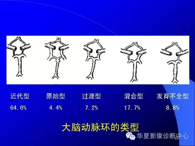 蝶鞍-脑室-脑池（高清+详细标注）