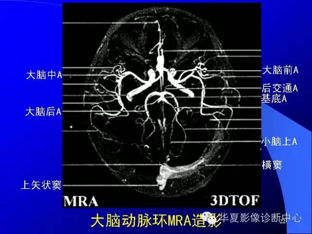 蝶鞍-脑室-脑池（高清+详细标注）