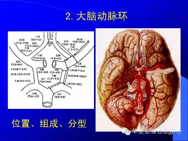 蝶鞍-脑室-脑池（高清+详细标注）