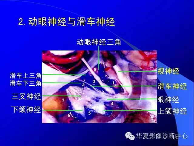 蝶鞍-脑室-脑池（高清+详细标注）