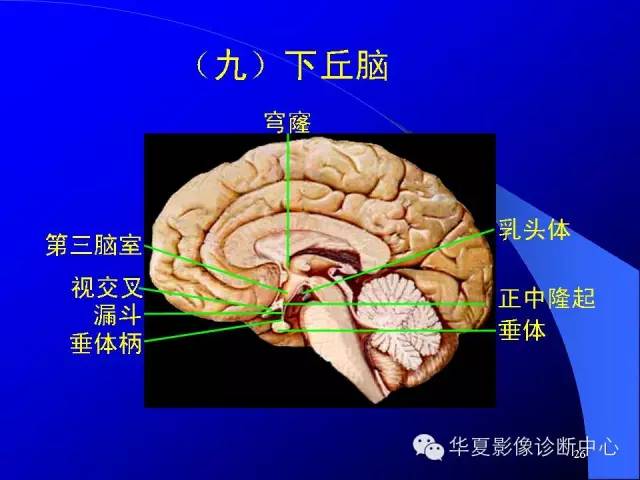 蝶鞍-脑室-脑池（高清+详细标注）