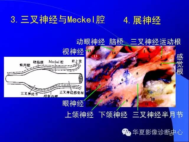 蝶鞍-脑室-脑池（高清+详细标注）