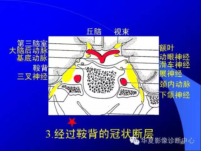 蝶鞍-脑室-脑池（高清+详细标注）