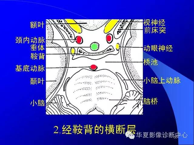 蝶鞍-脑室-脑池（高清+详细标注）