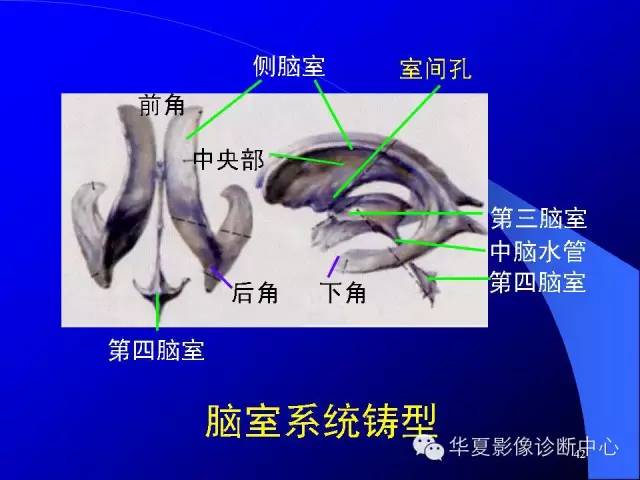 蝶鞍-脑室-脑池（高清+详细标注）