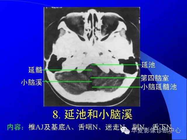 蝶鞍-脑室-脑池（高清+详细标注）