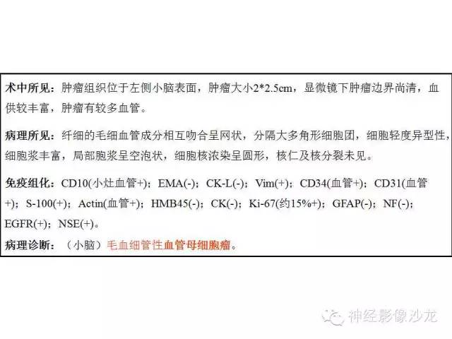 【病例】小脑血管母细胞瘤1例影像表现