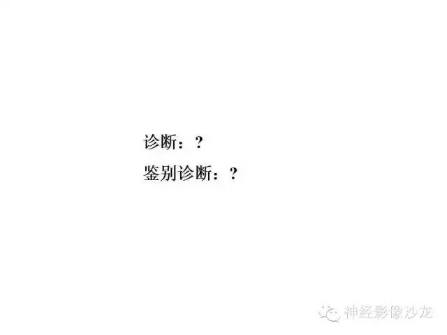 【病例】小脑血管母细胞瘤1例影像表现