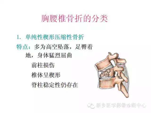 脊柱骨折分型 脊柱骨折分型