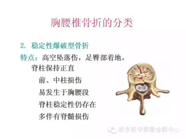 脊柱骨折分型 脊柱骨折分型
