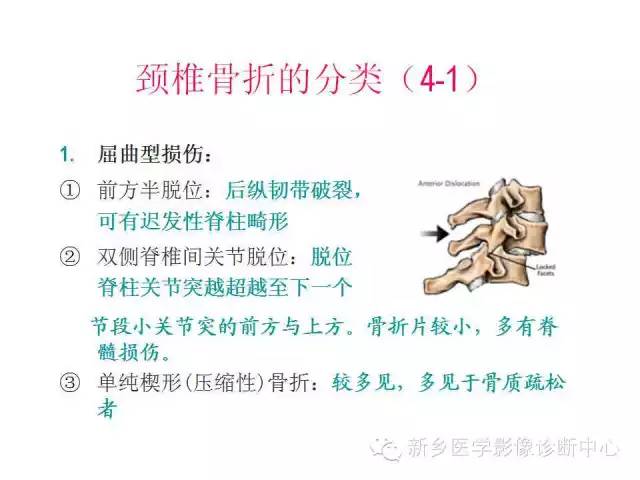 脊柱骨折分型 脊柱骨折分型