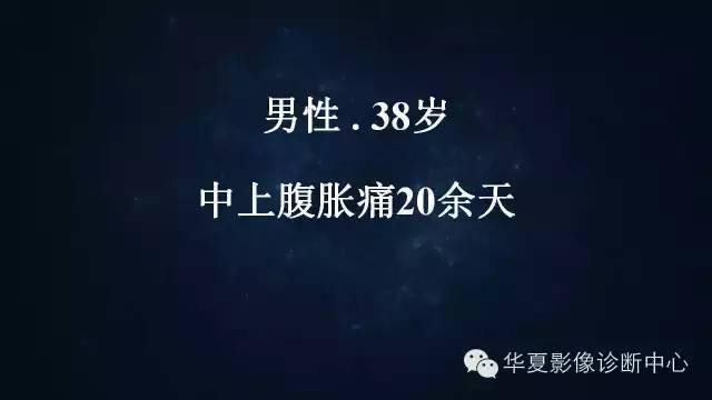 【病例】胃克罗恩氏病1例CT影像表现