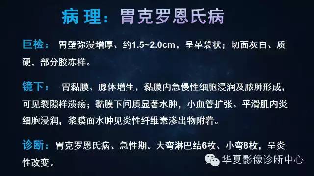 【病例】胃克罗恩氏病1例CT影像表现