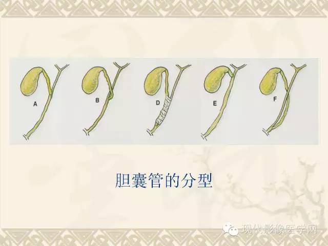 【PPT】腹部肿瘤CT读片小常识