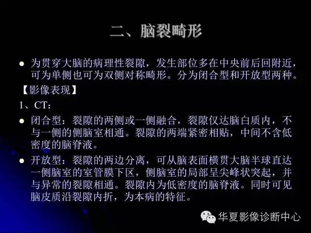 【PPT】颅脑先天发育畸形