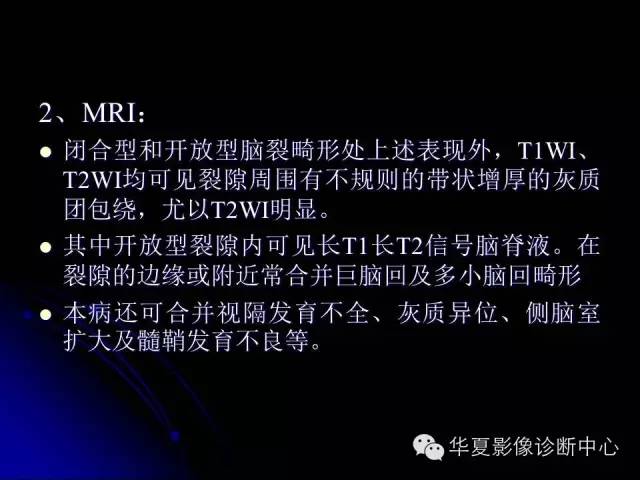 【PPT】颅脑先天发育畸形