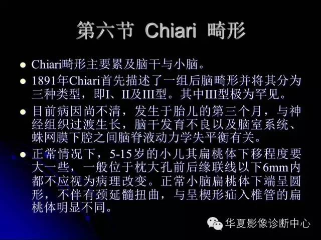 【PPT】颅脑先天发育畸形